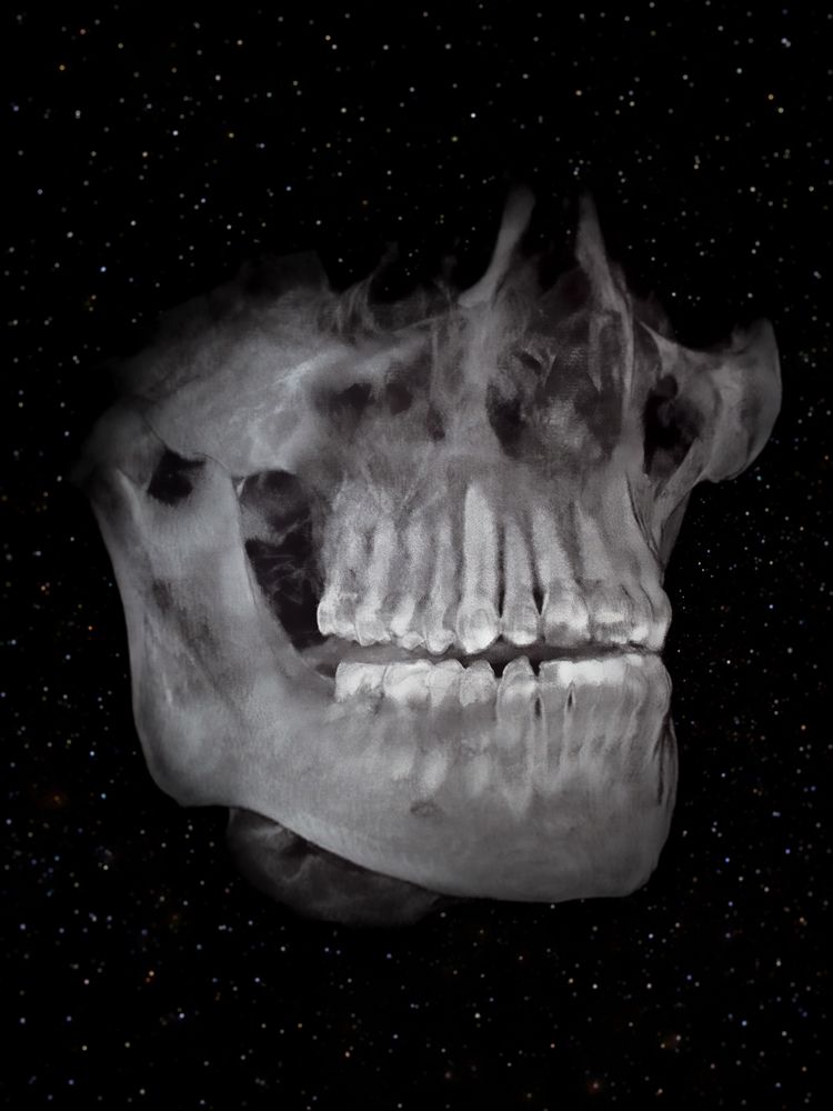 Images may contain CT scans of a person's face and head
