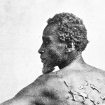 A picture of an elderly man showing scars in black people.