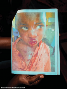 A family member shared a photo with EIA investigators showing their symptoms related to the mine's proximity to their home. Residents told the agency that sulfur dioxide emissions are disproportionately affecting the community's children. Photo credit: Herman Kambala/Arete/EIA
